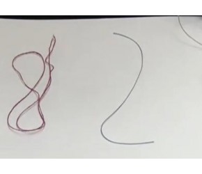 探秘埋线减肥 美容院到底埋的什么线?