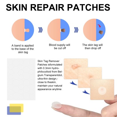 ELAIMEI 简易疣子去除皮肤工具Skin Tag Removal Kit图3