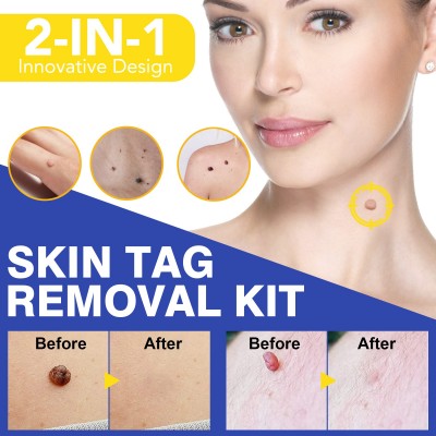 ELAIMEI 简易疣子去除皮肤工具Skin Tag Removal Kit图5