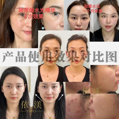 三文鱼水光动能素精华液功效型浅导居家水光DNA钠原液水光原液 1瓶